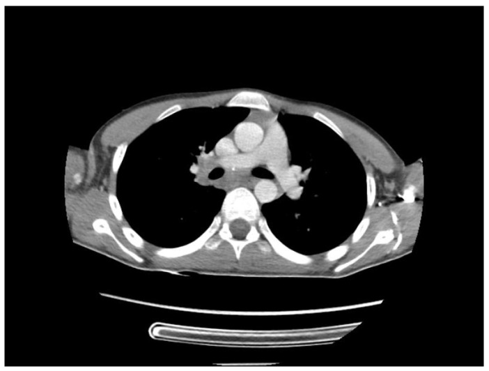 Figure 10