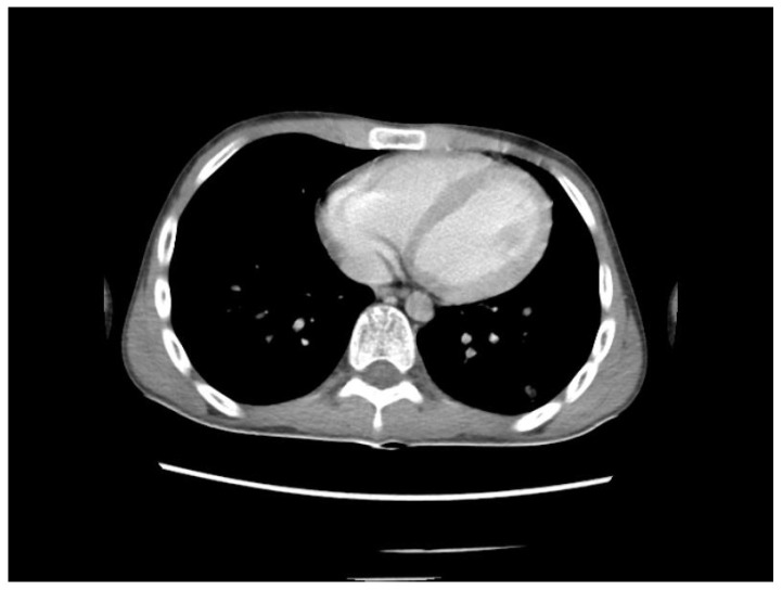 Figure 11