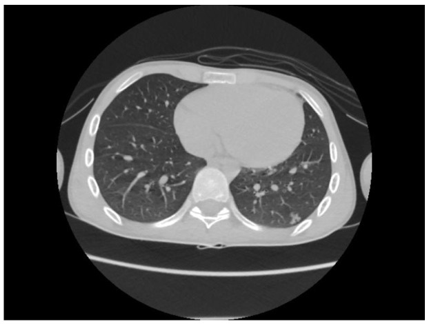 Figure 12