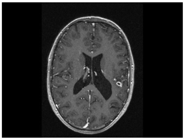 Figure 14