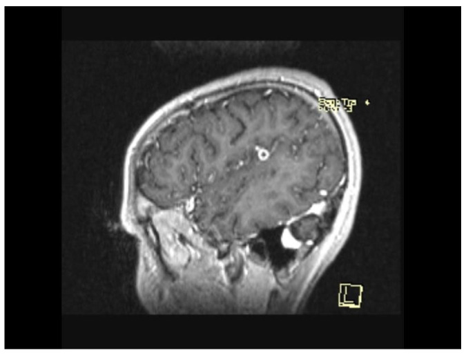 Figure 15