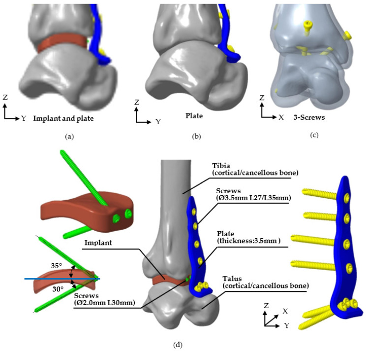 Figure 4