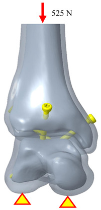 Figure 12
