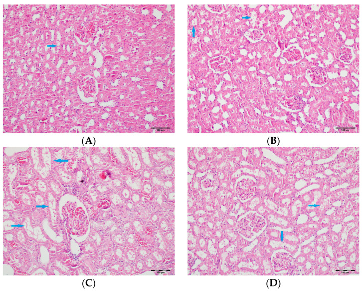 Figure 11