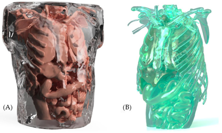 Figure 14