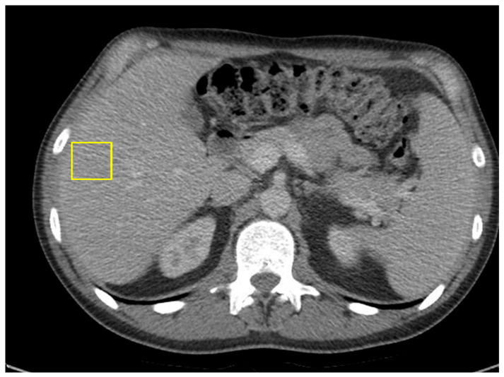 Figure 7