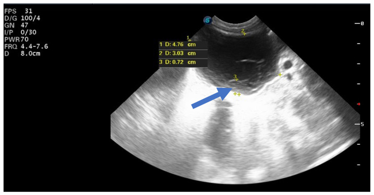 Figure 6