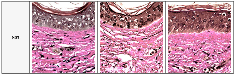 Figure 13