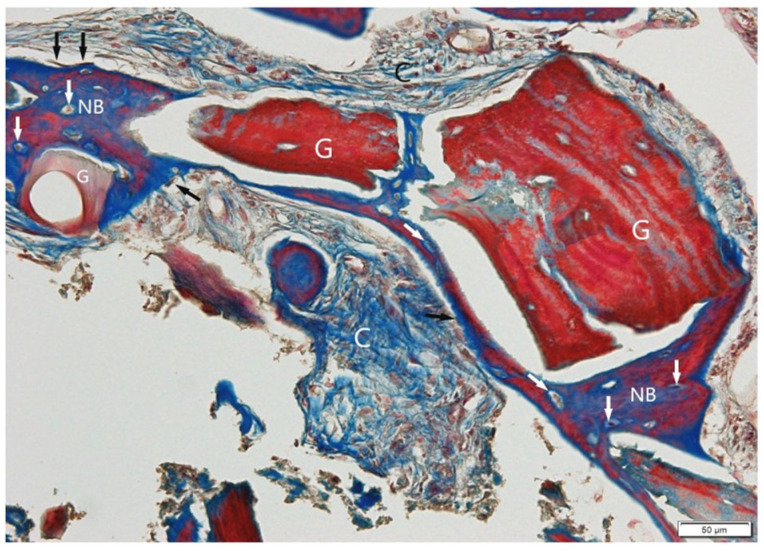 Figure 11