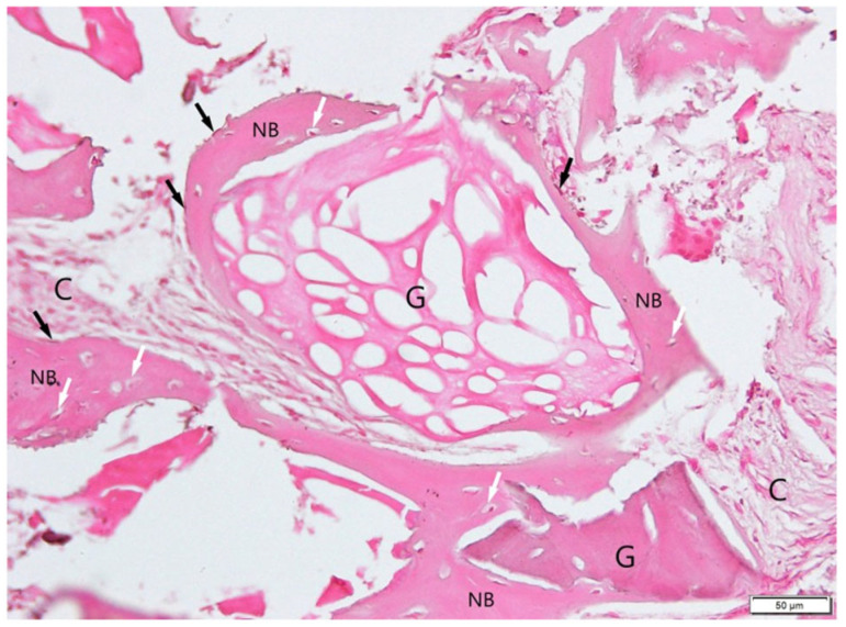 Figure 12