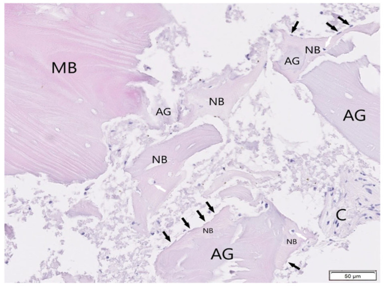 Figure 14