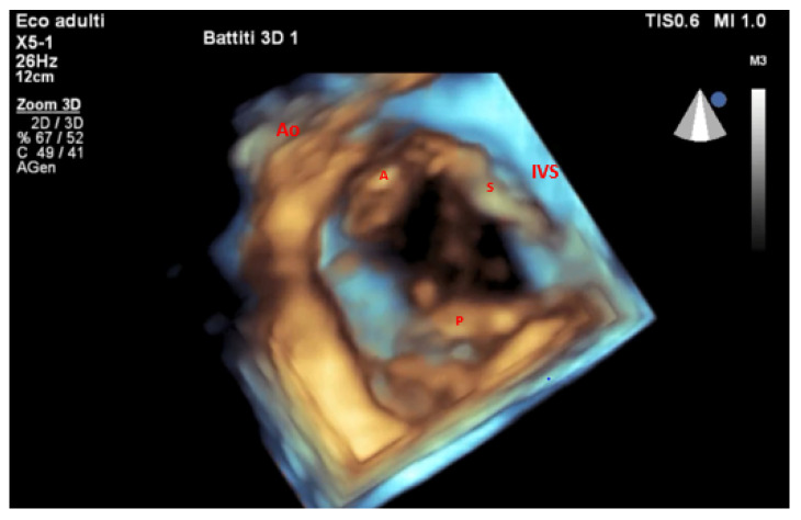 Figure 4