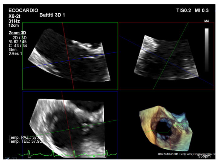 Figure 5