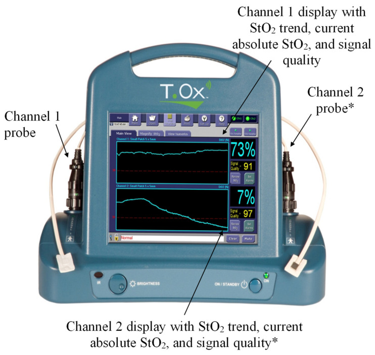 Figure 2