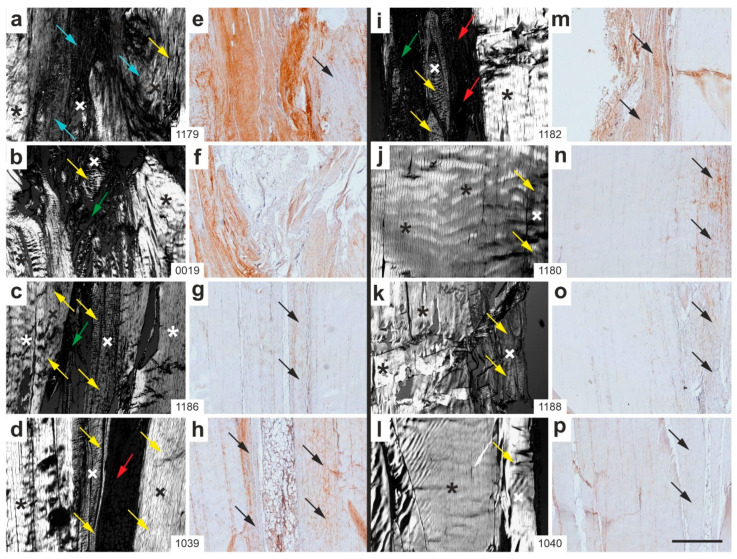 Figure 11