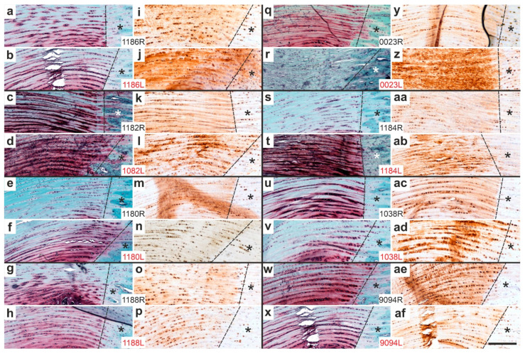 Figure 17