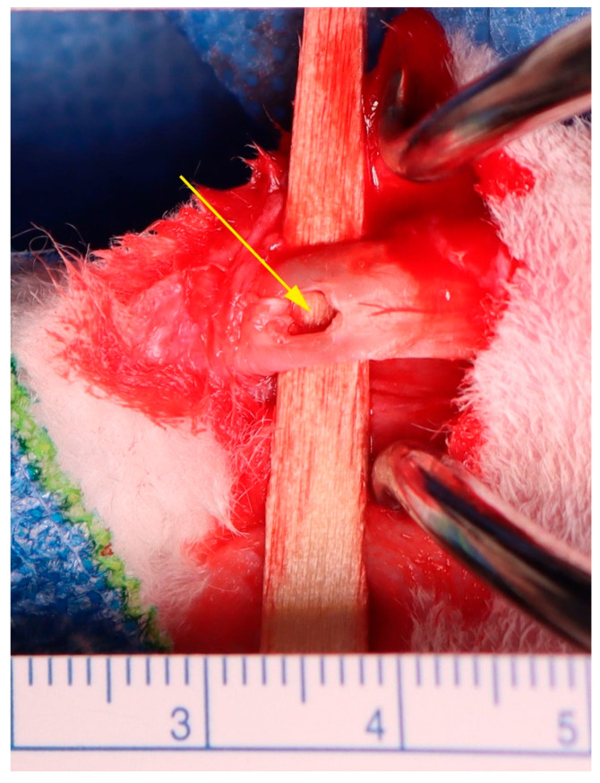 Figure 22