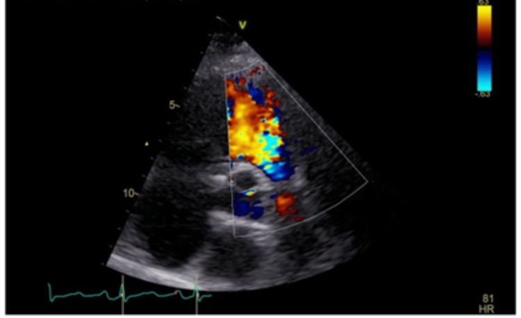 Figure 6