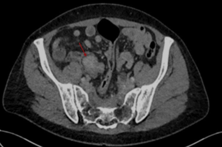 Figure 12