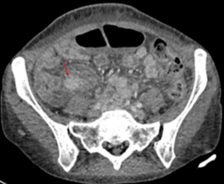 Figure 13