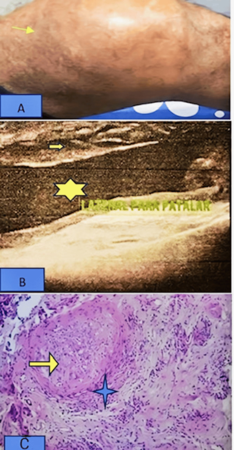 Figure 9