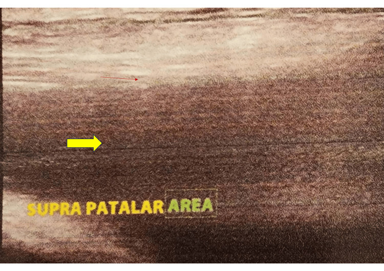 Figure 11