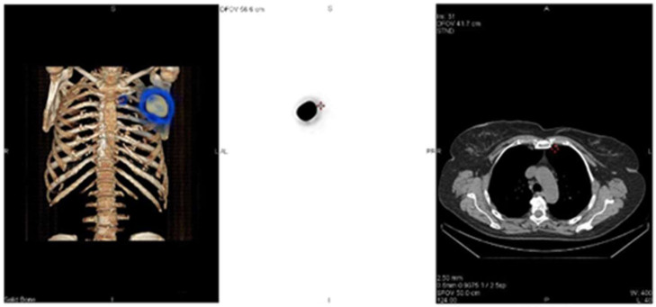 Figure 11
