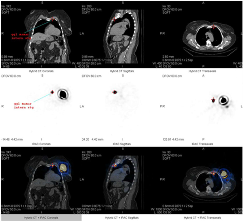 Figure 12