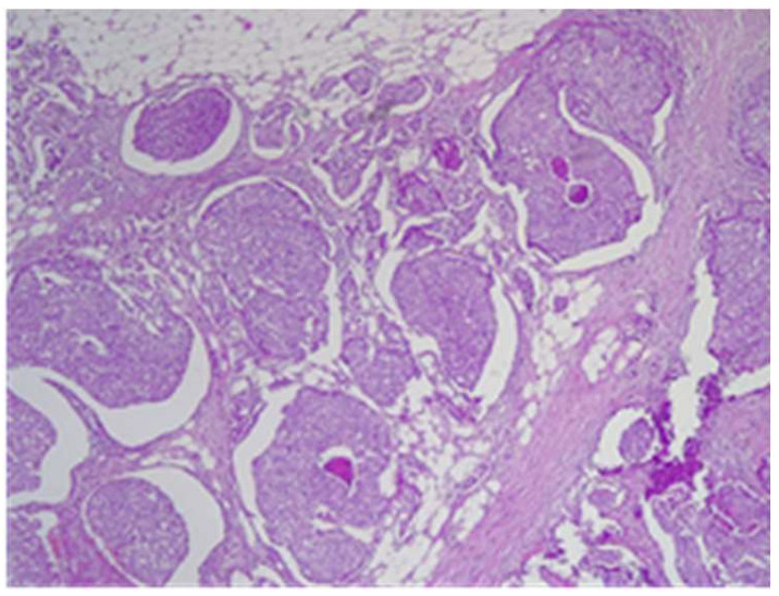 Figure 18
