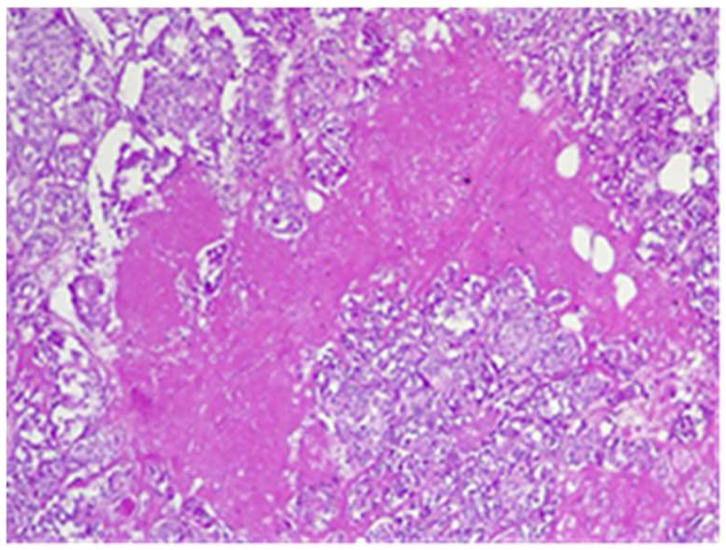 Figure 20