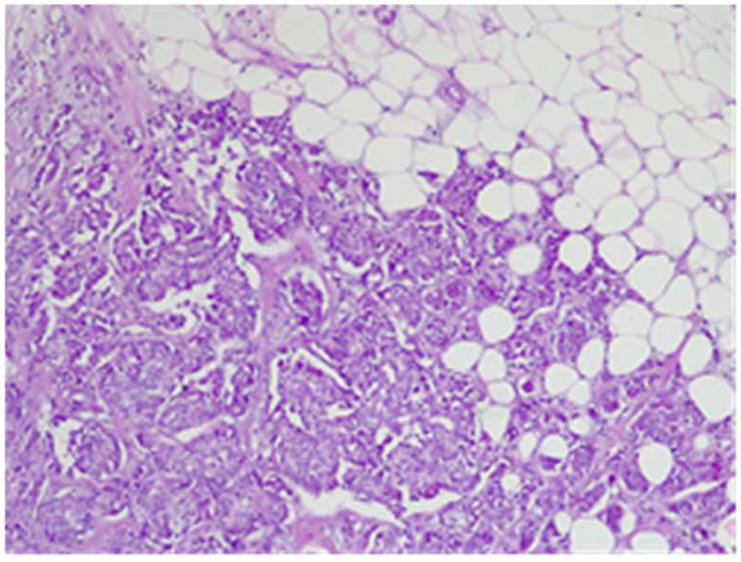 Figure 21