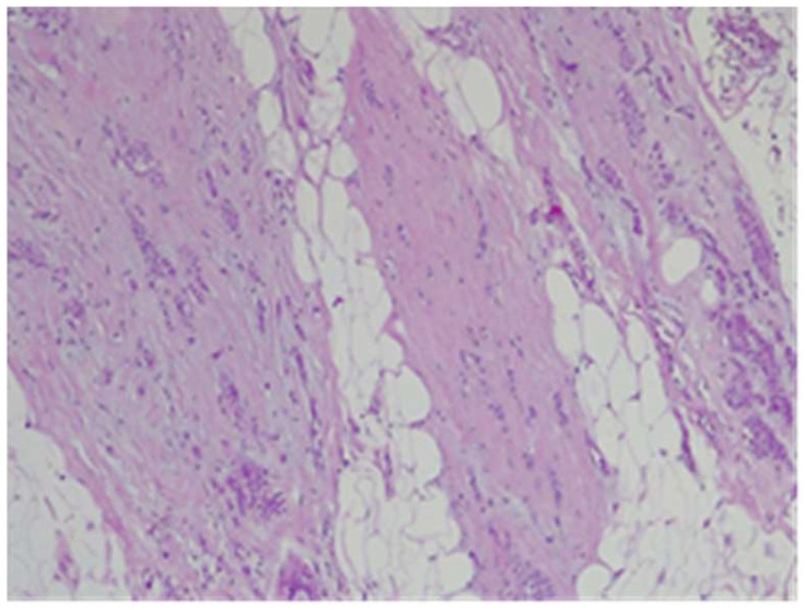 Figure 22