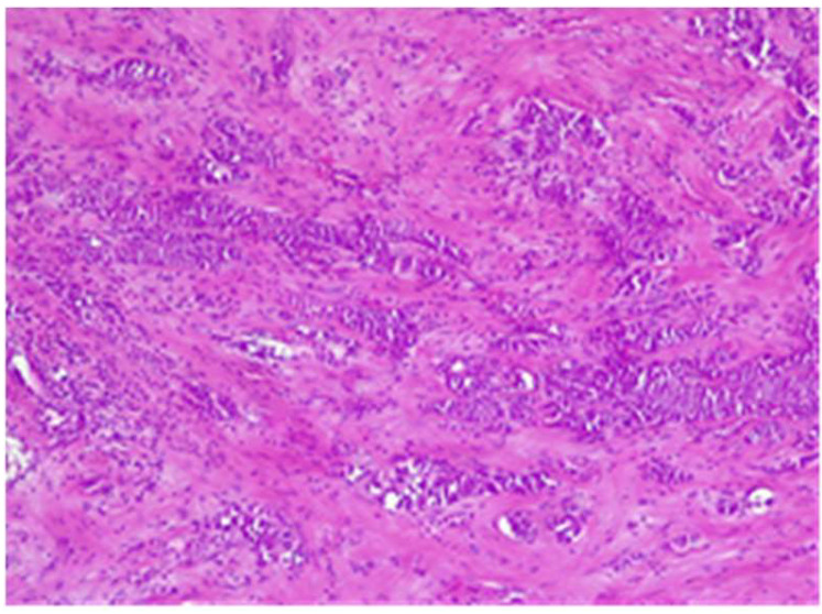 Figure 23