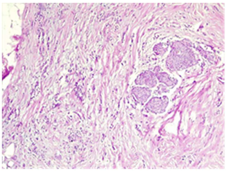 Figure 25