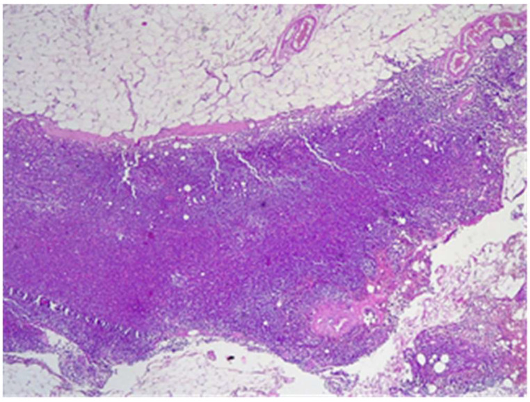 Figure 26