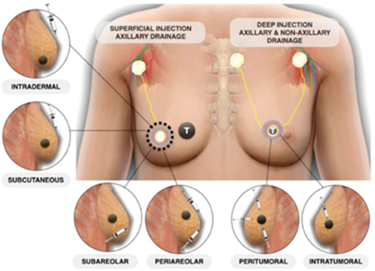 Figure 28