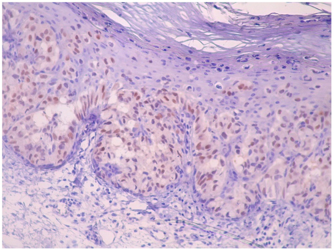 Figure 10