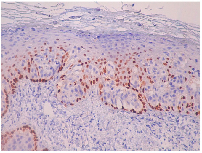 Figure 11