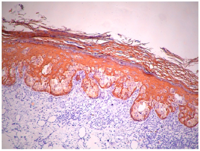 Figure 12