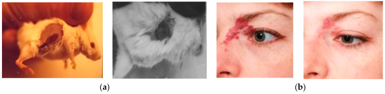 Figure 14