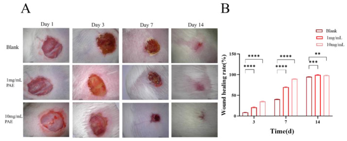 Figure 11