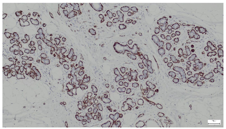 Figure 14