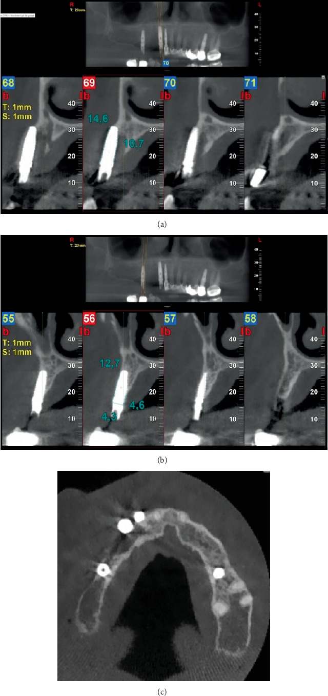 Figure 9