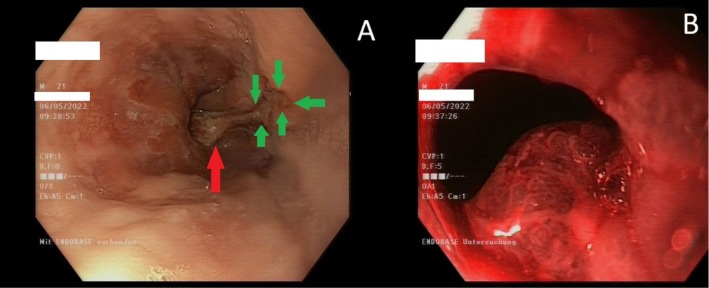 FIGURE 1