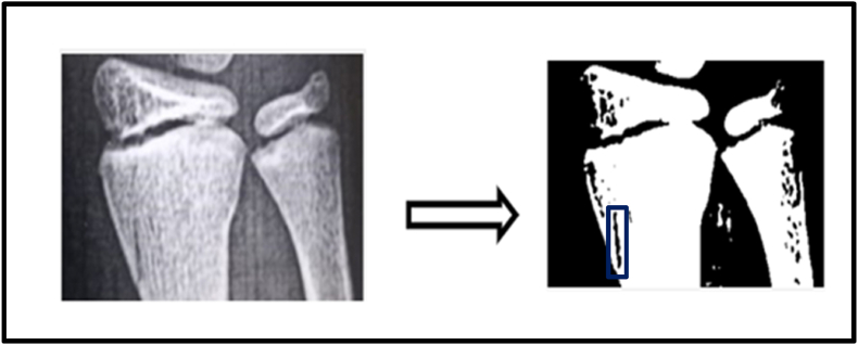 Figure 12