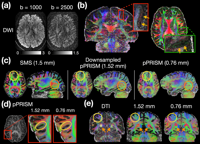 Fig. 13