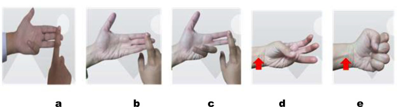 Fig.2