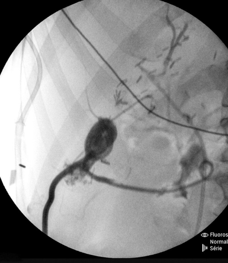 Fig. 3