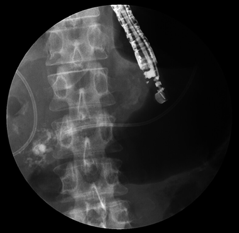 Fig. 2