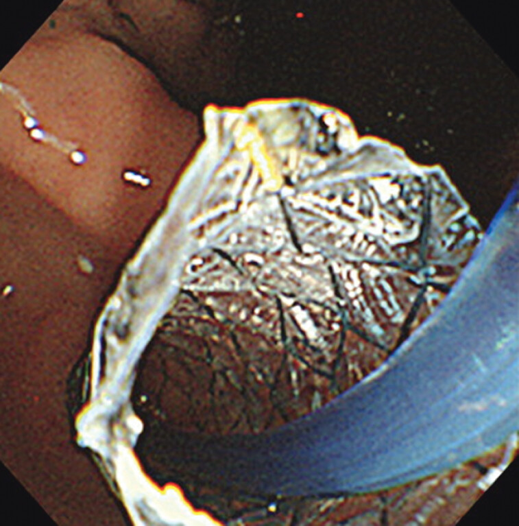 Fig. 3